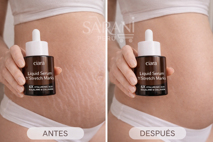 CIARA ANTI-ESTRÍAS PRO🔥